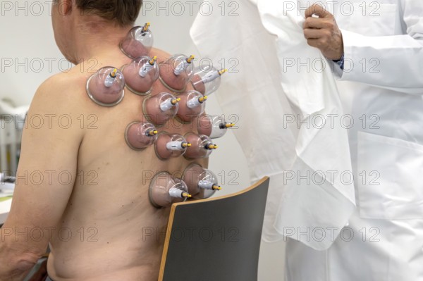 Back cupping