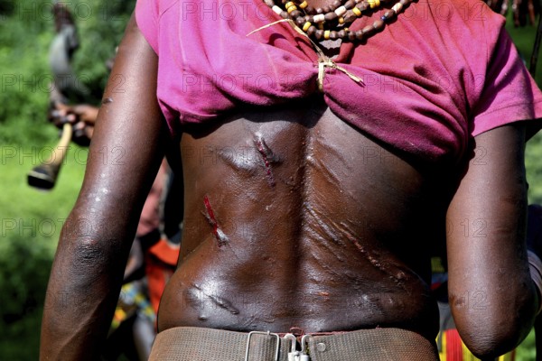 Hamer ritual with scars as part of the initiation process, Turmi, Ethiopia