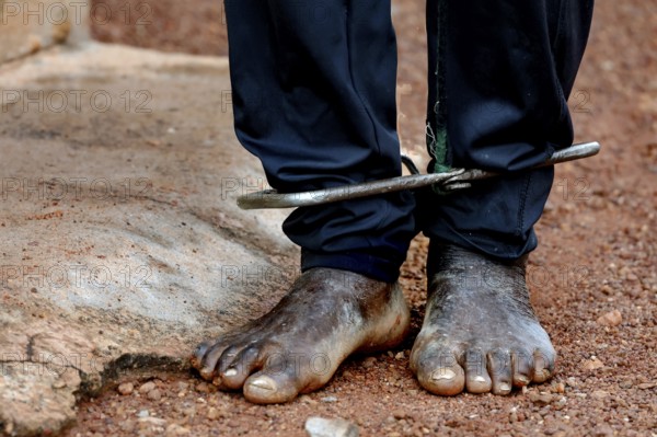 Cuffed feet in sandy surroundings illustrate mental distress, Korhogo, Ivory Coast
