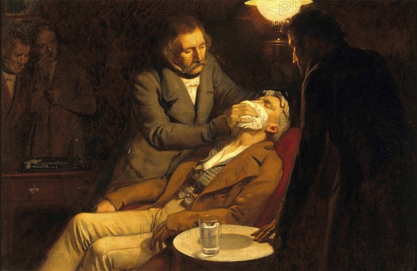 Zahnarzt, Betäubung, Anästhesie, Narkose. Die erste Verwendung von Äther in der Zahnchirurgie, 1846. Ölgemälde von Ernest Board Medizin, Medizingeschichte, Gemälde, historisch