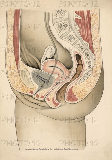 Medical illustration, clinical picture, venereal disease, schematic representation of female private parts, school picture, authentic reproduction of a school mural, around 1900, exact date unknown, historical