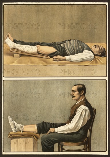 First aid, emergency bandage for varicose bleeding and injuries, school picture, authentic reproduction of a school mural, around 1911, exact date unknown, historical