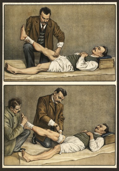 First aid, broken leg is tied off by two helpers, school picture, authentic reproduction of a school mural, around 1911, exact date unknown, historical