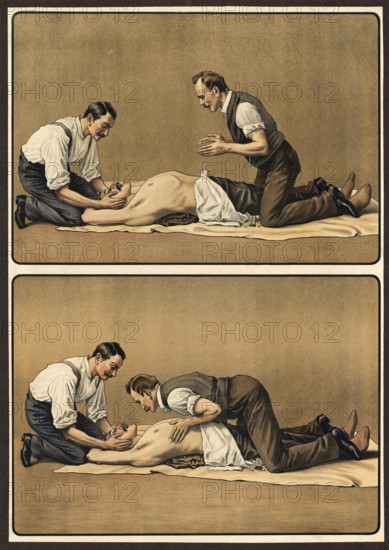 First aid, depiction of artificial respiration by two helpers, school picture, authentic reproduction of a school mural, around 1911, exact date unknown, historical