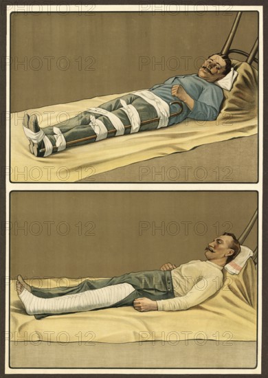 First aid, emergency treatment for broken bones, school picture, authentic reproduction of a school mural, around 1911, exact date unknown, historical