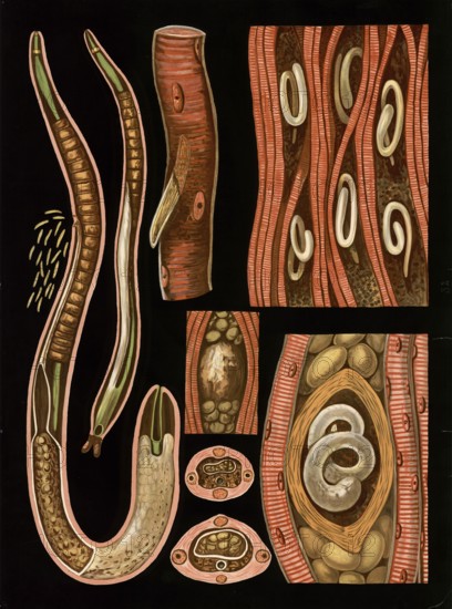 Scientific illustration with details, nematode, trichinella spiralis, school picture, authentic reproduction of a school mural, around 1909, based on an original by Gottlieb von Koch, exact date unknown, historical