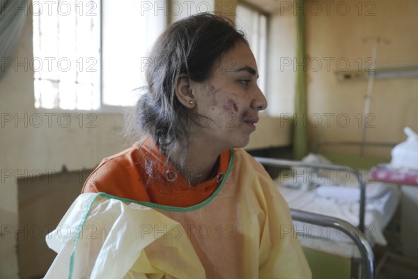 Wounded individuals receiving treatment at a hospital after being evacuated with difficulty from Sweida city in southern Syria due to sectarian violence between Druze factions and Bedouin tribes
