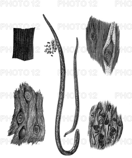 Muscle trichinae, woodcut from 1864