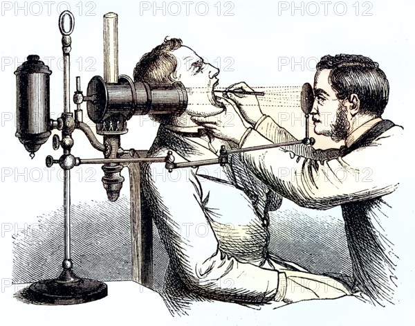 Historical illustration of the medication of a larynx, viewing with light, medicine/Historical illustration of the medication of a Larynx, viewing with light, medicine, historical, digitally restored reproduction of an original original from the 19th century, exact original date not known, subsequently colored