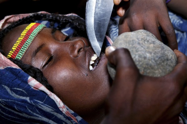 Aisha has her teeth sharpened by a man, Ahmedela, Tigray, Ethiopia