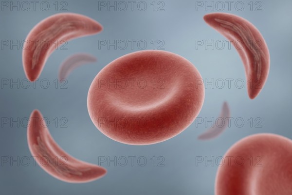 Visualization of CRISPR gene therapy for sickle cell anemia: An altered red blood cell that produces reactivated fetal hemoglobin maintains its healthy, round shape as opposed to deformed sickle cells in the background. molecular biology, genetics, biotechnology, hematology, gene therapy, AI generated
