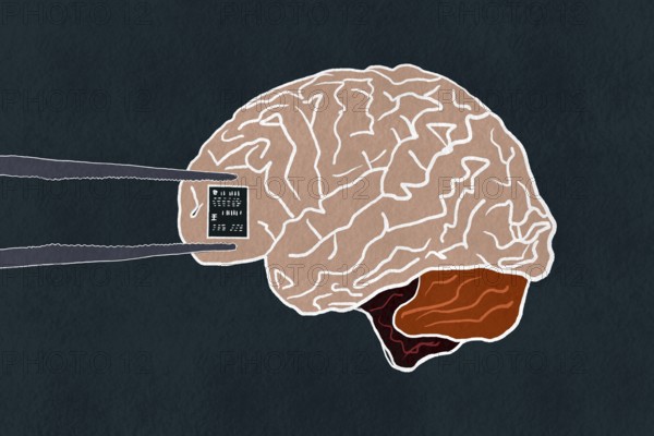 An illustration depicting a human brain with tweezers installing a microchip This concept highlights the integration of technology with human cognition, symbolizing future advancements