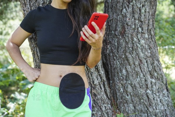 A woman with a visible ostomy stands outdoors, leaning against a tree, holding a red smartphone She wears a black top and green shorts, symbolizing empowerment and resilience