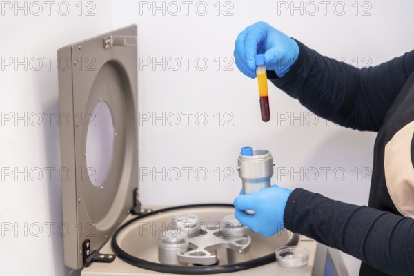 Close-up side view of a technician using blood centrifuge machine for an innovative baldness treatment