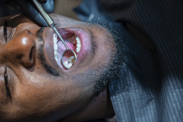 Dentist wearing black gloves using a dental mirror to examine patient's teeth during a checkup at a dental clinic