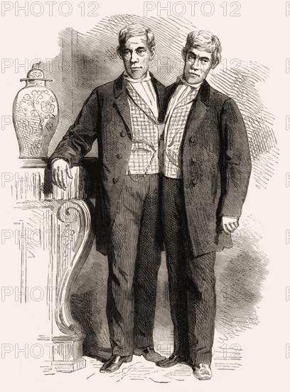 Chang and Eng Bunker, 1811–1874, known as the Siamese Twins, digitally edited