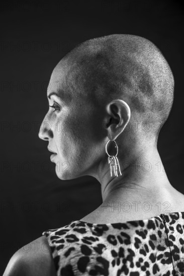 Black and white portrait of a bald woman in profile, showcasing elegant earrings and a patterned shirt, highlighting beauty and confidence against a subtle dark background