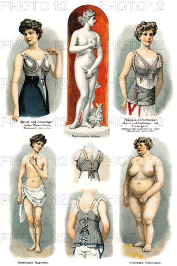 Abnormal and normal body shapes of women, health counselor, 19th century, Abnorme und normale Körperformen der Frauen, Gesundheitsratgeber, 19. Jahrhundert