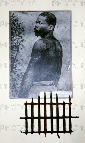 Das historische Foto zeigt den einzigen Überlebenden des Ausbruchs des Vulkans Montagne Pelee auf Martinique im Mai 1902. Der Mann, ein Gefängnisinsasse, kam mit Brandwunden davon. Die Hafenstadt St. Pierre wurde durch eine Wolke glühenden Gases völlig zerstört. Rund 40.000 Menschen kamen ums Leben +++(c) dpa - Report+++