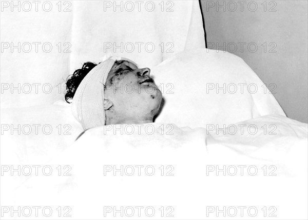 Edith Piaf at the Rambouillet hospital after her car accident, September 7, 1958