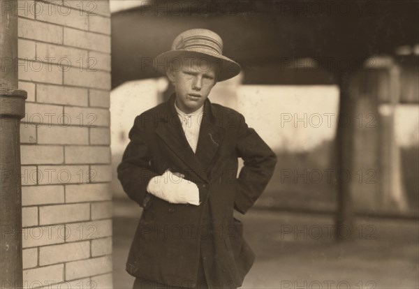 Portrait of 13-year-old Boy with Injured Hand While Working as Doffer at Cotton Mill, Weldon, North Carolina, USA, Lewis Hine, 1914
