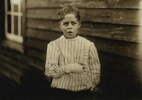 Giles Edmund Newsom, Young Cotton Mill Worker, 12 years old, Fell on to Spinning Machine and his hand went to into unprotected gearing, losing two fingers, Half-length Portrait, Sanders Spinning Mill, Bessemer City, North Carolina, USA, Lewis Hine for National Child Labor Committee, October 1912