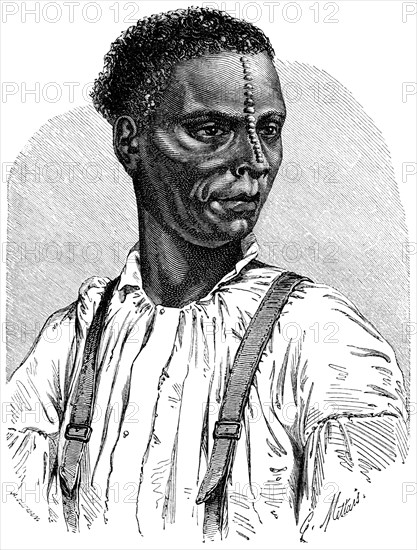 “Knopneuz” (button-nose) of the lower Congo, Illustration from the book, "Volkerkunde" by Dr. Friedrich Ratzel, Bibliographisches Institut, Leipzig, 1885