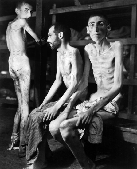 Russian, Polish, and Dutch slave laborers interned at Buchenwald concentration camp averaged 160 pounds each prior to entering camp 11 months ago. Their average weight is now 70 pounds, Weimar, Germany, U.S. Army Signal Corps, April 16, 1945