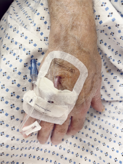 Hospital patient with IV port inserted in his hand