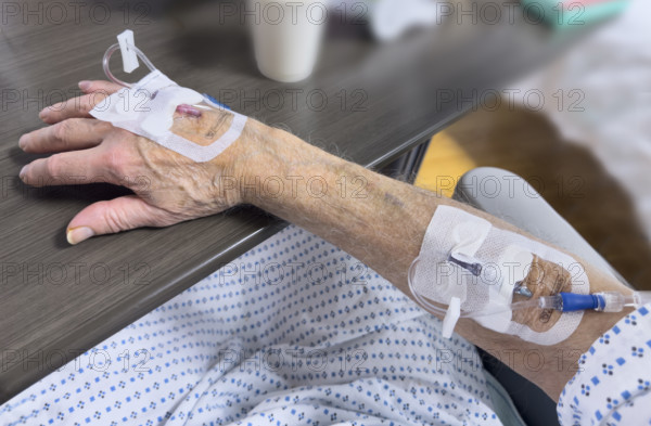 Hospital patient with IV ports inserted in his hand and forearm