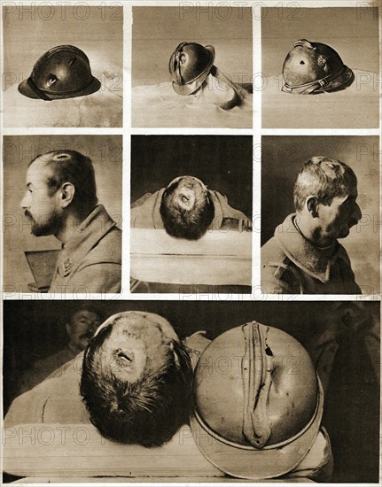 Illustration of the efficiency of the new steel helmets