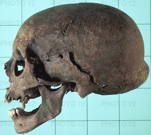 Stages in facial reconstruction of the bathrocranic skull. Artist: Unknown