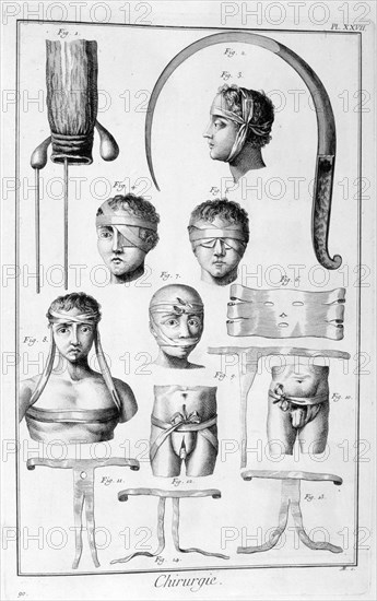 Surgery, 1751-1777. Artist: Unknown