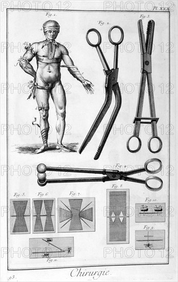 Surgery, 1751-1777. Artist: Unknown