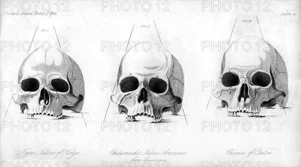 Three types of human skull, 1848. Artist: Unknown