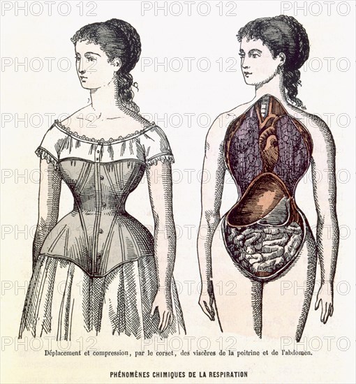 The Harmful Effects of the Corset (Phénomènes chimiques de la respiration), illustration from La Vie