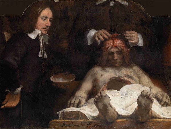 The Anatomy Lesson of Dr. Jan Deijman, 1656. Artist: Rembrandt van Rhijn (1606-1669)