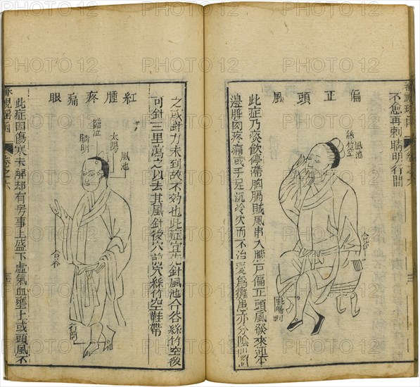 Shen Shi Yao Han (A Precious Book of Ophthalmology), 1644. Artist: Fu Renyu (active Mid of 17th cen.)