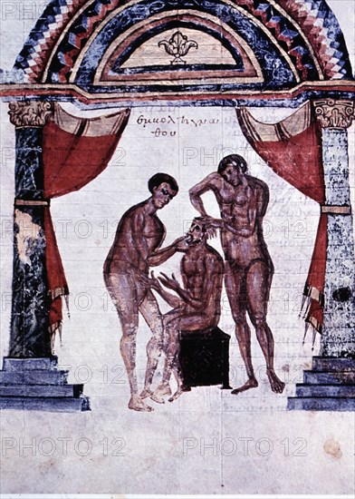Mandibular reduction, miniature in the Surgery Codex in Comments of Apollonius, by Cizio the 8th ?