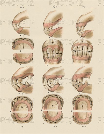 Description of Plate Showing the Age, As Indicated By The Teeth', c1879.