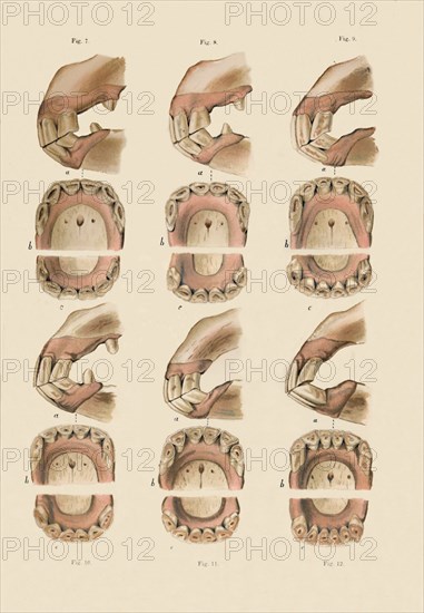 Description of Plate Showing the Age, As Indicated By The Teeth', c1879.