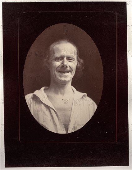 Figure 32: Rire naturel par la contraction volontaire des deux grands zygomatiques..., c. 1856. Creator: Guillaume-Benjamin-Amand Duchenne (de Boulogne) (French, 1806-1875); Adrien Tournachon (French, 1825-1903).