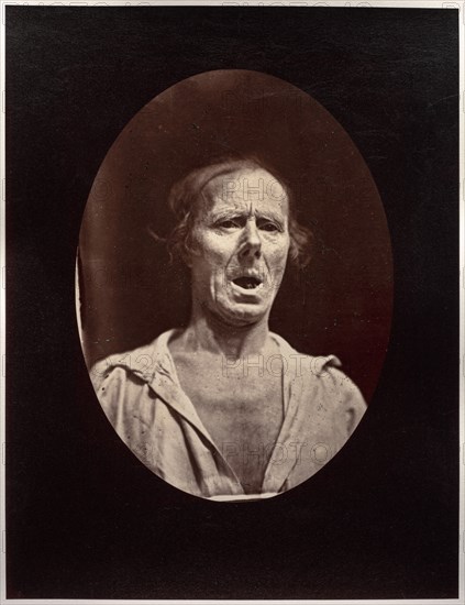 Figure 54: Abaissement volontaire de la mâchoire inférieure: mouvement inexpressif, c. 1856. Creator: Guillaume-Benjamin-Amand Duchenne (de Boulogne) (French, 1806-1875); Adrien Tournachon (French, 1825-1903).