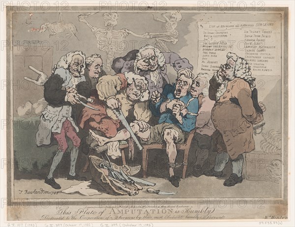 Amputation, February 17, 1786.