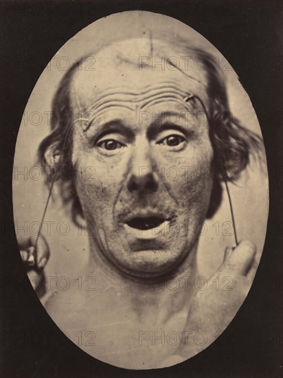Figure 56: Surprise, 1854-56, printed 1862.
