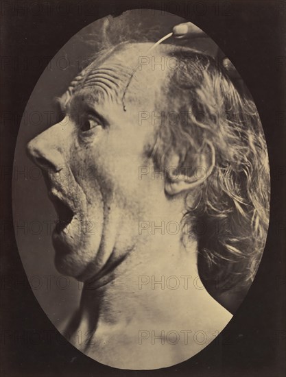 Figure 57: Astonishment, stupefaction, amazement, 1854-56, printed 1862.
