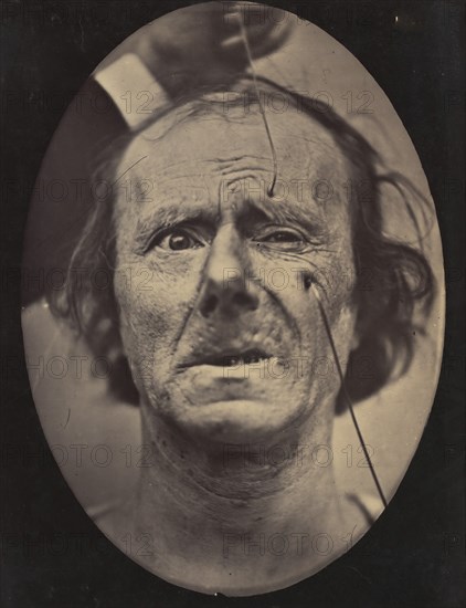 Figure 49: Painful weeping and forward looking., 1854-56, printed 1862.