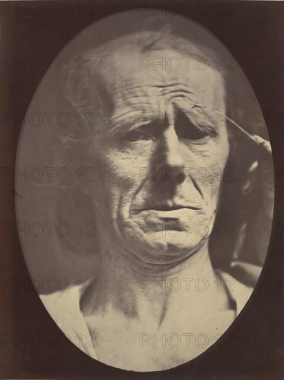 Figure 22: No painful expression , 1854-56, printed 1862.