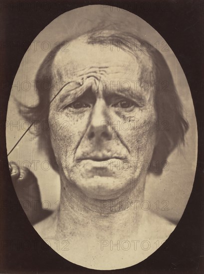 Figure 19: Suffering , 1854-56, printed 1862.