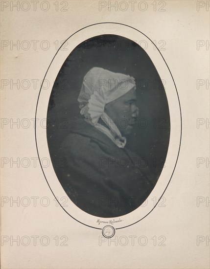 [Profile of a Woman with Necrosis of the Nose], 1841-48.